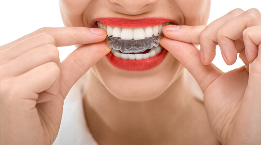 Orthodontie-Alfortville-soins